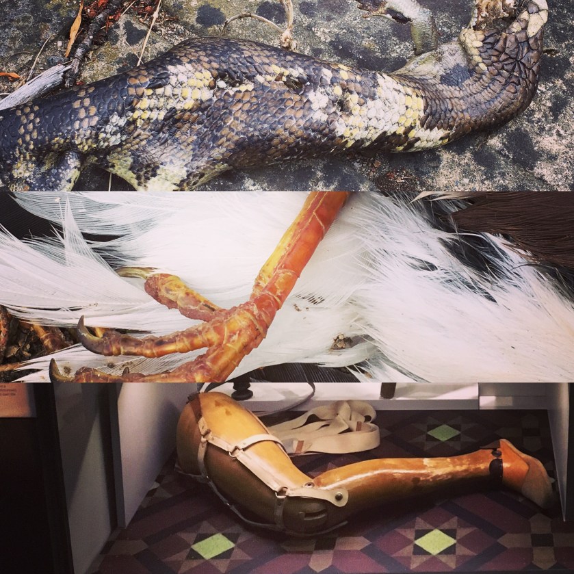 prosthesis-photo-collage